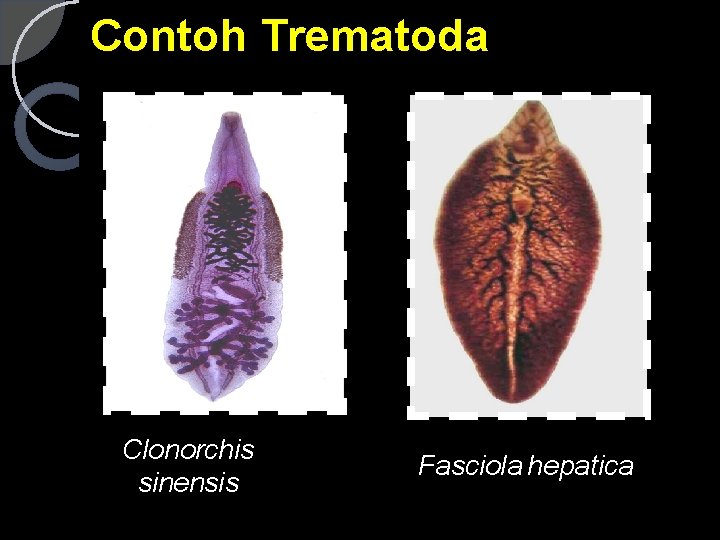 Contoh Trematoda Clonorchis sinensis Fasciola hepatica 