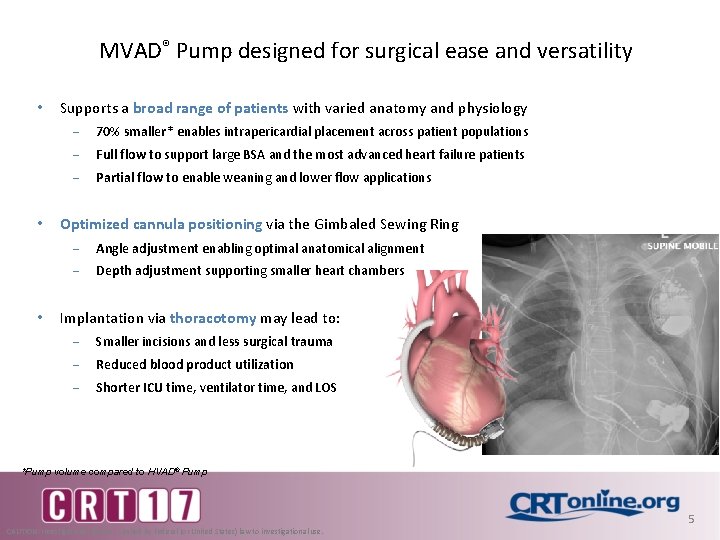 MVAD® Pump designed for surgical ease and versatility • • • Supports a broad