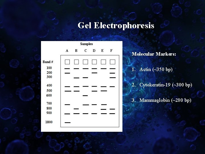 Gel Electrophoresis Molecular Markers: 1. Actin (~350 bp) 2. Cytokeratin-19 (~300 bp) 3. Mammaglobin