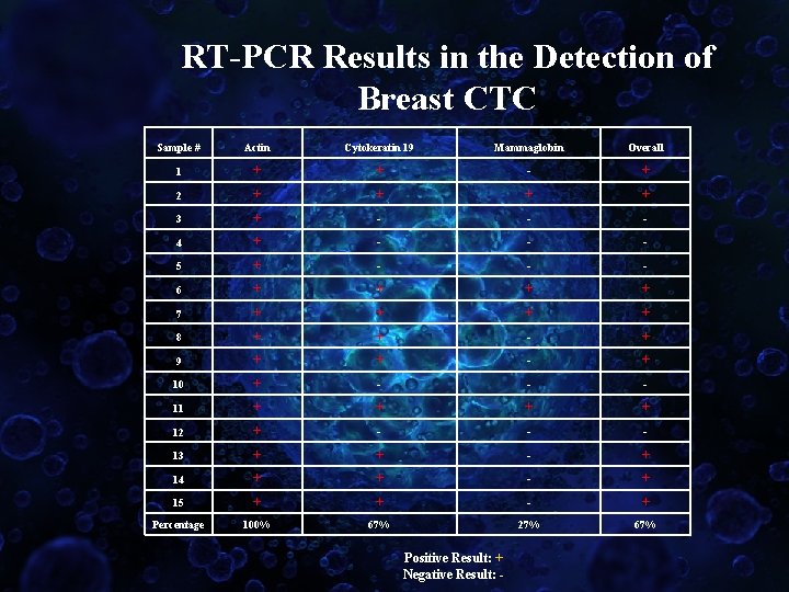 RT-PCR Results in the Detection of Breast CTC Sample # Actin Cytokeratin 19 Mammaglobin