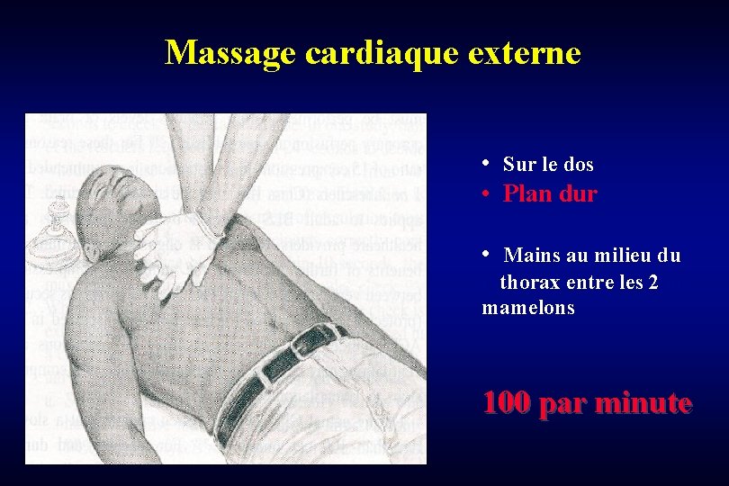 Massage cardiaque externe • Sur le dos • Plan dur • Mains au milieu