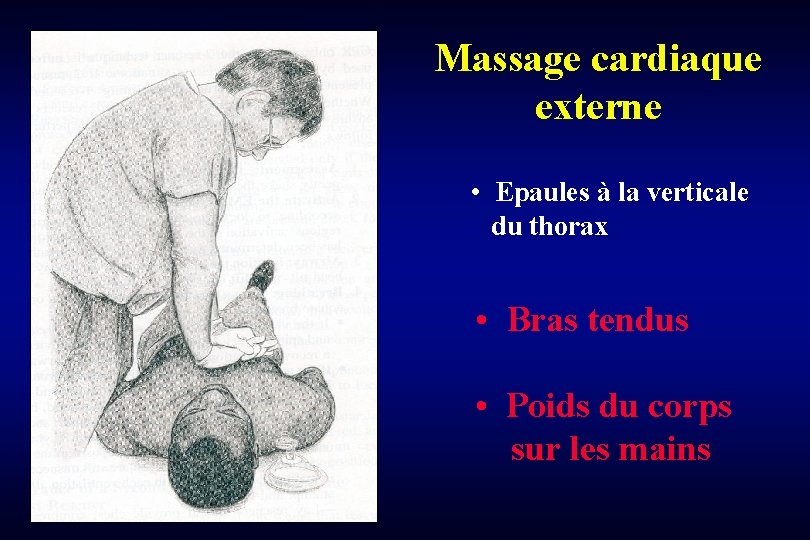 Massage cardiaque externe • Epaules à la verticale du thorax • Bras tendus •