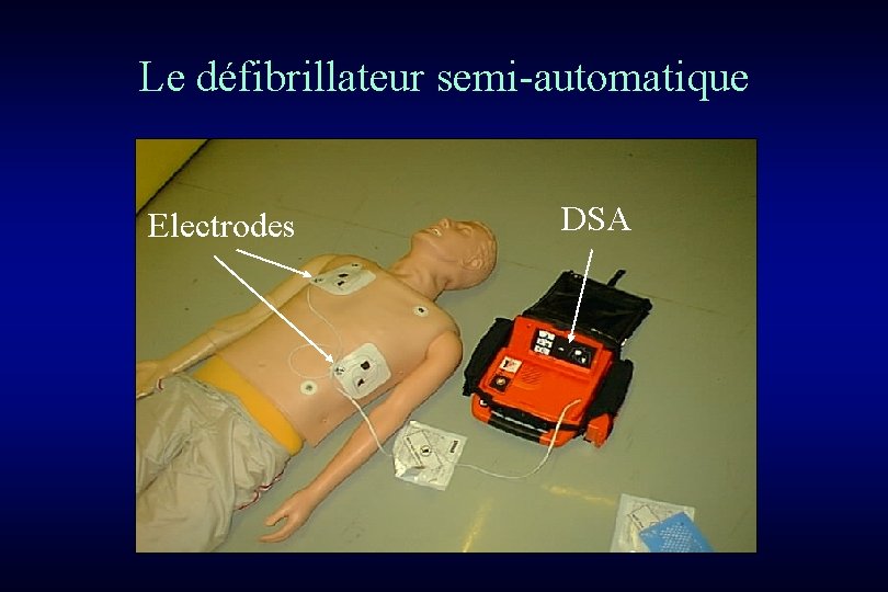 Le défibrillateur semi-automatique Electrodes DSA 
