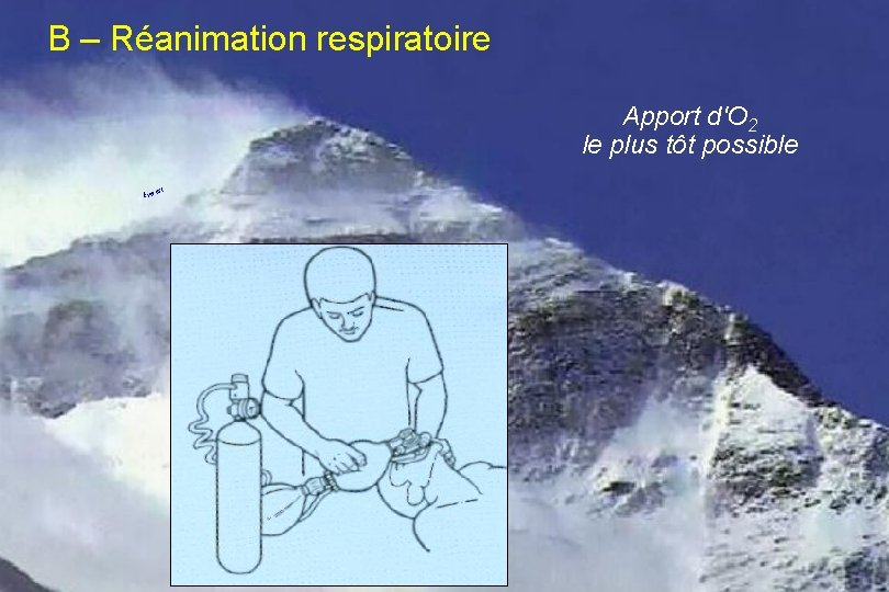 B – Réanimation respiratoire Apport d'O 2 le plus tôt possible t Everes 