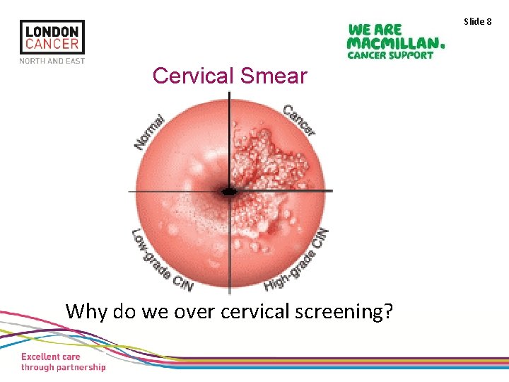 Slide 8 Cervical Smear Why do we over cervical screening? 