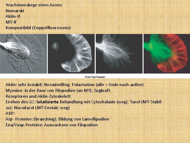 Wachstumskege eines Axons: Nomarski Aktin-IF MT-IF Kompositbild (Doppelfluoreszenz) Aktin: sehr instabil; threadmilling; Polarisation (alle