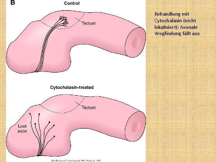 Behandlung mit Cytochalasin (nicht lokalisiert): Axonale Wegfindung fällt aus 