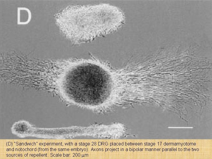 (D) “Sandwich” experiment, with a stage 28 DRG placed between stage 17 dermamyotome and