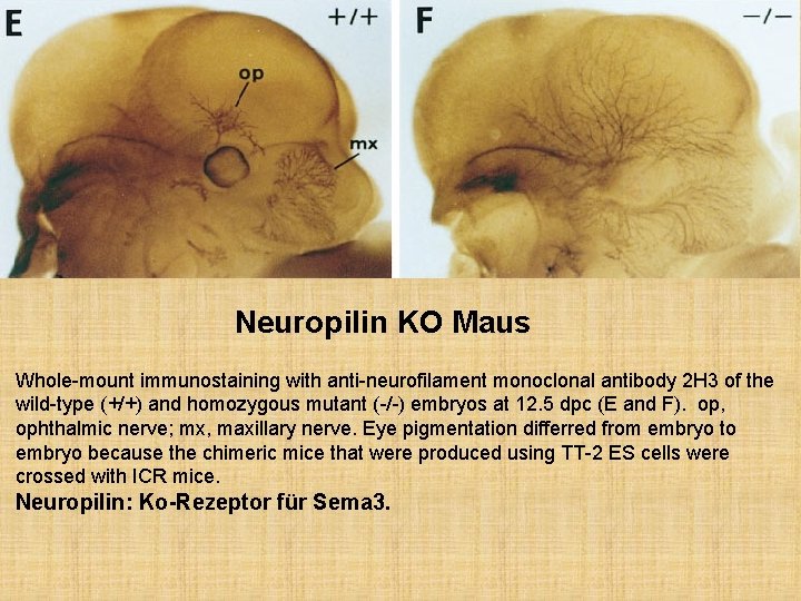 Neuropilin KO Maus Whole-mount immunostaining with anti-neurofilament monoclonal antibody 2 H 3 of the