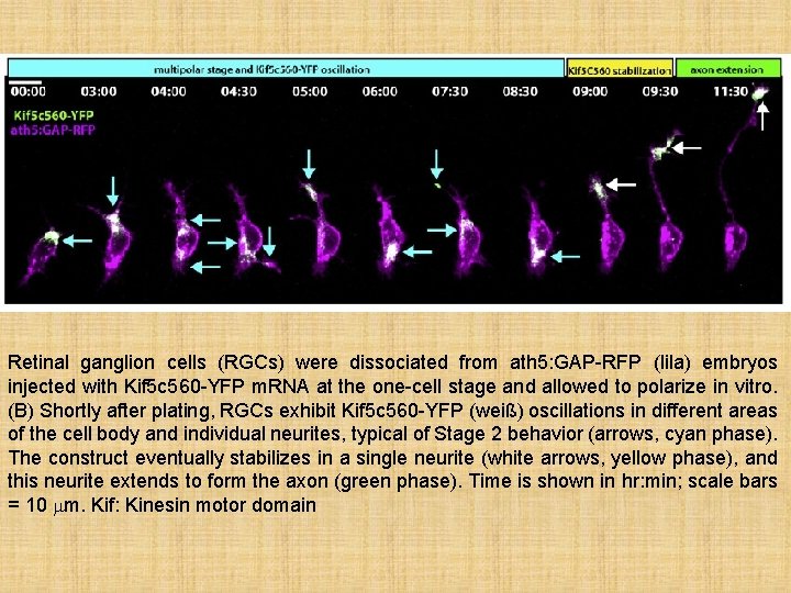 Retinal ganglion cells (RGCs) were dissociated from ath 5: GAP-RFP (lila) embryos injected with