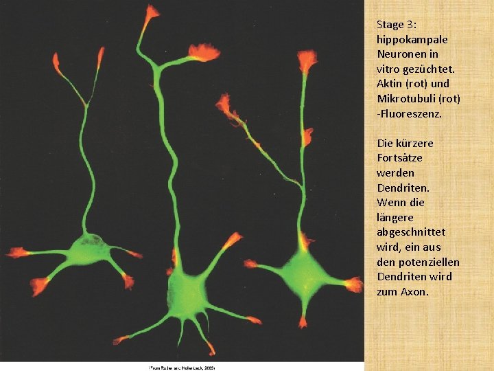 Stage 3: hippokampale Neuronen in vitro gezüchtet. Aktin (rot) und Mikrotubuli (rot) -Fluoreszenz. Die