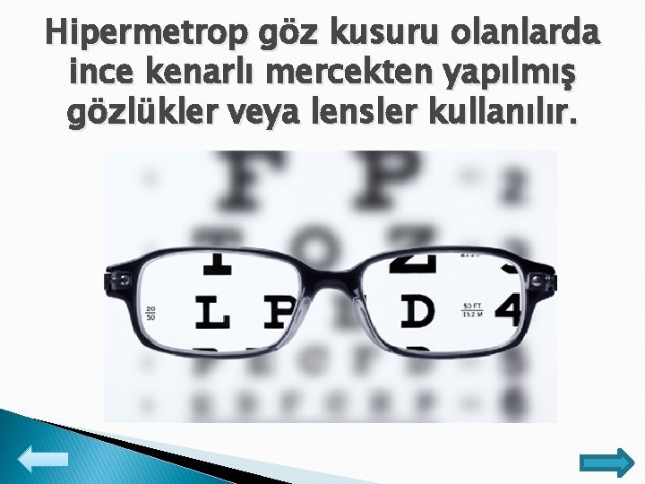 Hipermetrop göz kusuru olanlarda ince kenarlı mercekten yapılmış gözlükler veya lensler kullanılır. 