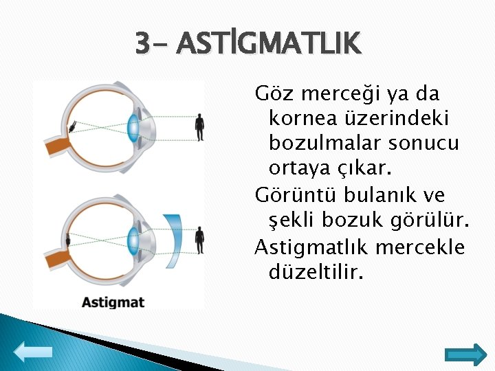 3 - ASTİGMATLIK Göz merceği ya da kornea üzerindeki bozulmalar sonucu ortaya çıkar. Görüntü