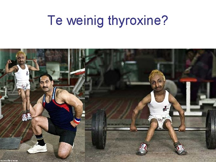 Te weinig thyroxine? 