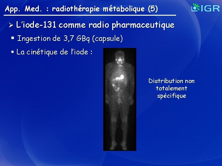 App. Med. : radiothérapie métabolique (5) Ø L’iode-131 comme radio pharmaceutique § Ingestion de