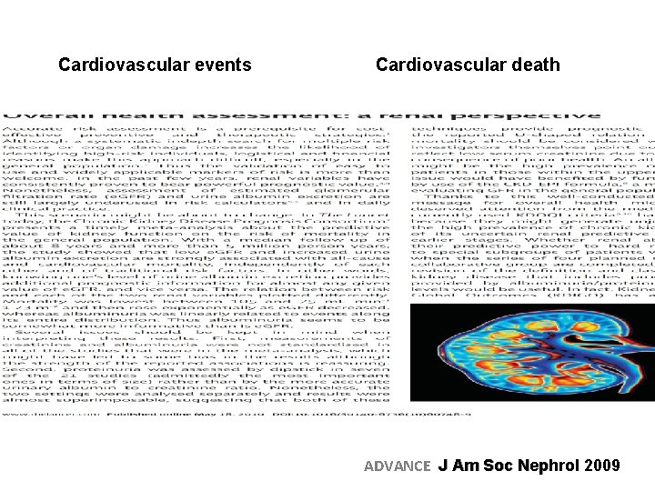 Cardiovascular events Cardiovascular death ADVANCE J Am Soc Nephrol 2009 