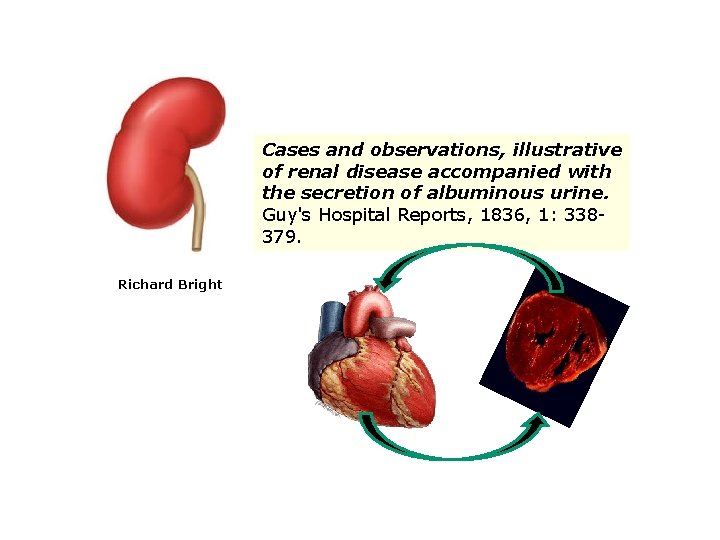 Cases and observations, illustrative of renal disease accompanied with the secretion of albuminous urine.