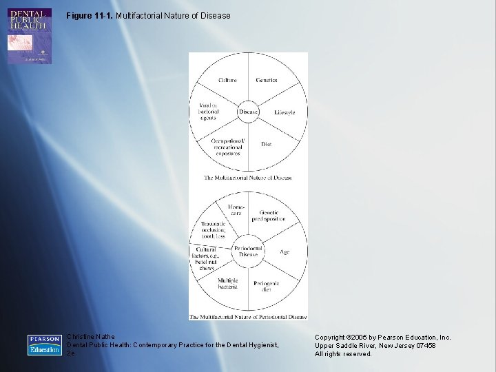 Figure 11 -1. Multifactorial Nature of Disease Christine Nathe Dental Public Health: Contemporary Practice
