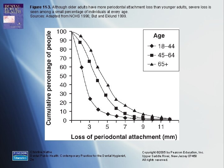 Figure 11 -3. Although older adults have more periodontal attachment loss than younger adults,