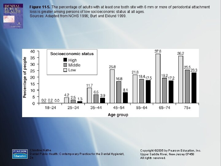 Figure 11 -5. The percentage of adults with at least one tooth site with