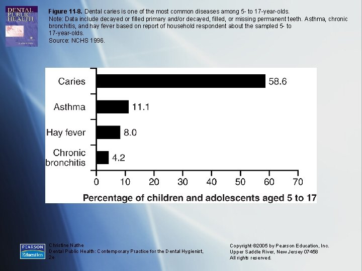 Figure 11 -8. Dental caries is one of the most common diseases among 5