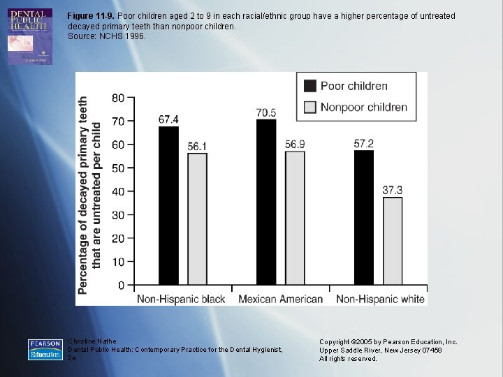 Figure 11 -9. Poor children aged 2 to 9 in each racial/ethnic group have