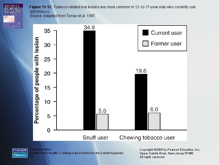 Figure 11 -12. Tobacco-related oral lesions are more common in 12 - to 17