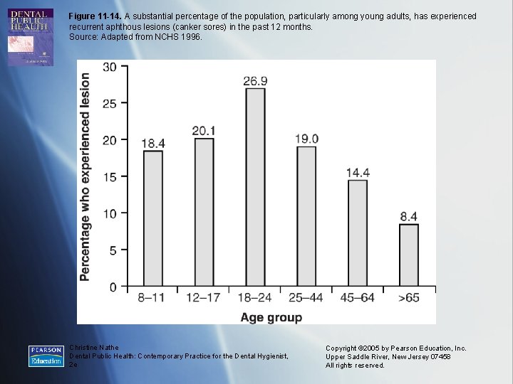 Figure 11 -14. A substantial percentage of the population, particularly among young adults, has