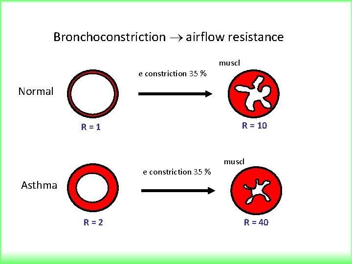 Bronchoconstriction airflow resistance e constriction 35 % muscl Normal R = 10 R=1 e