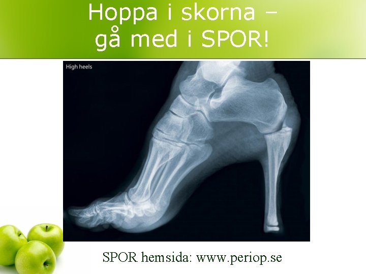 Hoppa i skorna – gå med i SPOR! SPOR hemsida: www. periop. se 
