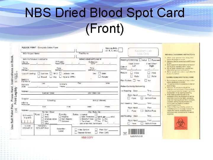 NBS Dried Blood Spot Card (Front) 