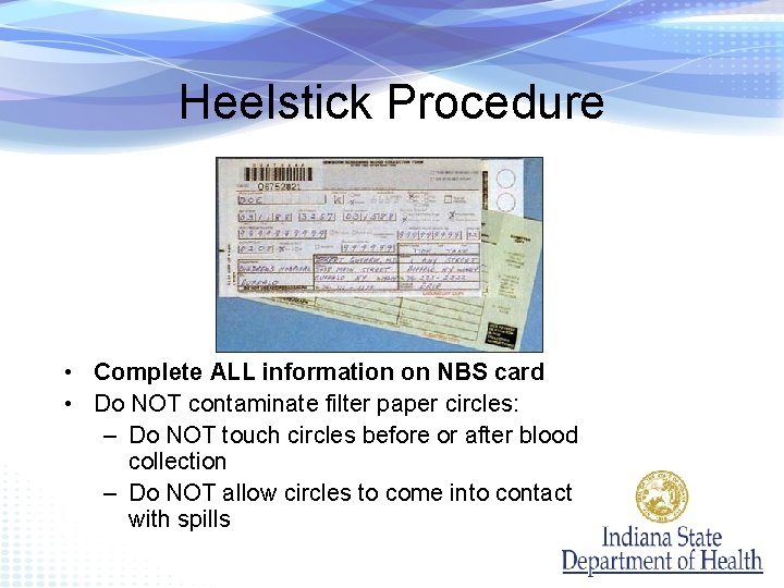 Heelstick Procedure • Complete ALL information on NBS card • Do NOT contaminate filter