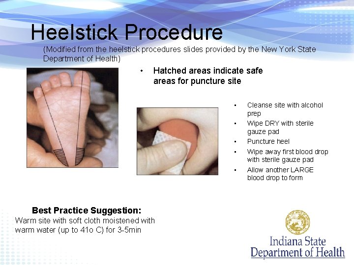 Heelstick Procedure (Modified from the heelstick procedures slides provided by the New York State
