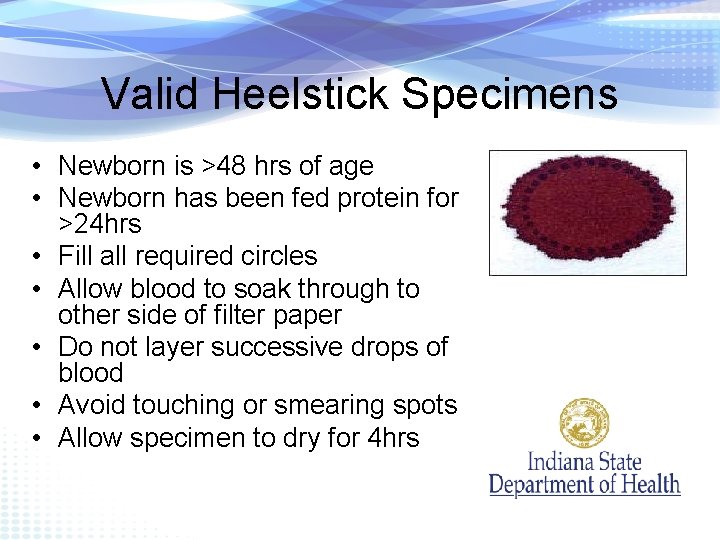 Valid Heelstick Specimens • Newborn is >48 hrs of age • Newborn has been