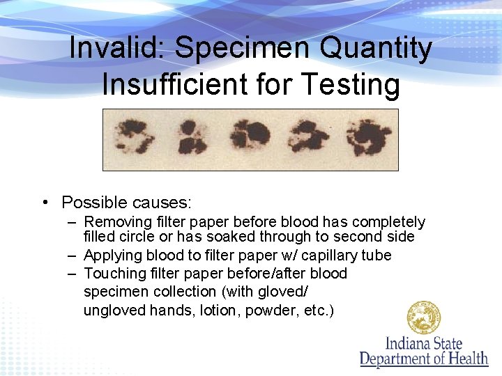 Invalid: Specimen Quantity Insufficient for Testing • Possible causes: – Removing filter paper before