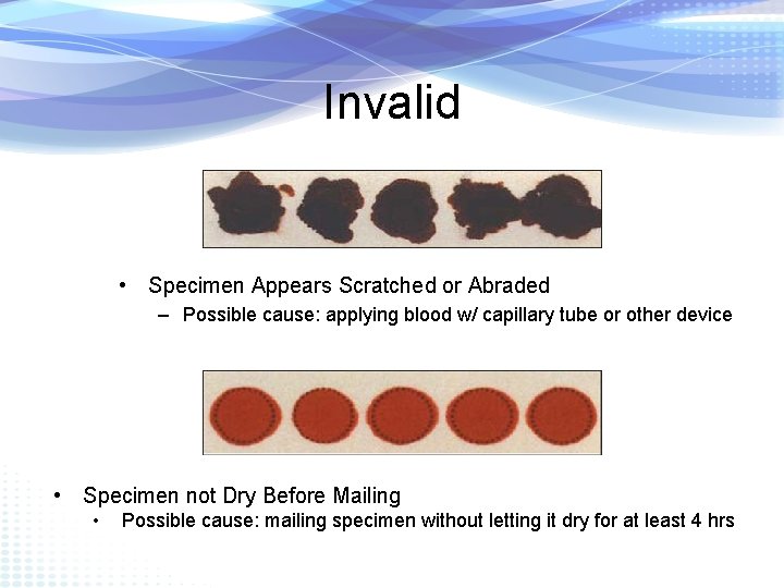 Invalid • Specimen Appears Scratched or Abraded – Possible cause: applying blood w/ capillary