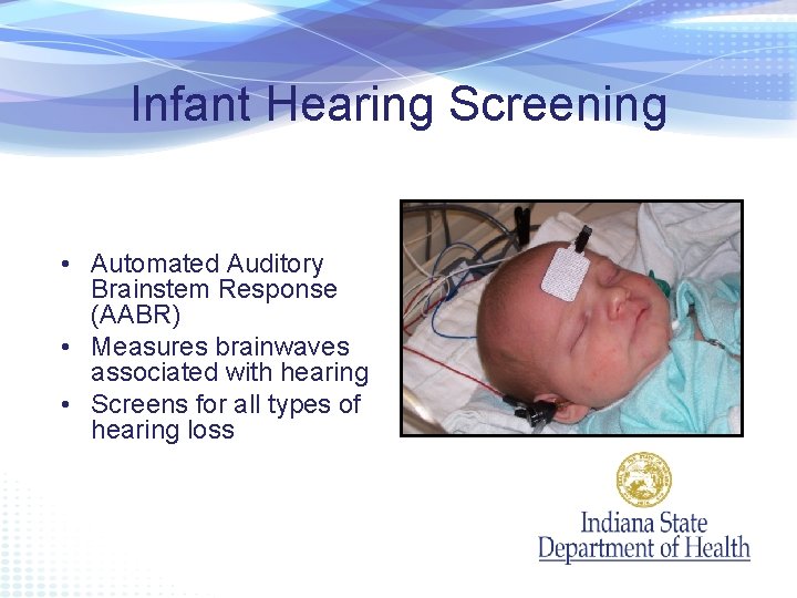 Infant Hearing Screening • Automated Auditory Brainstem Response (AABR) • Measures brainwaves associated with