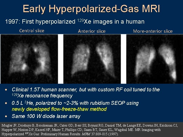 Early Hyperpolarized-Gas MRI 1997: First hyperpolarized 129 Xe images in a human Central slice