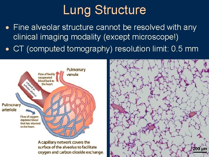 Lung Structure · Fine alveolar structure cannot be resolved with any clinical imaging modality