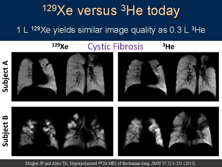 129 Xe versus 3 He today 1 L 129 Xe yields similar image quality