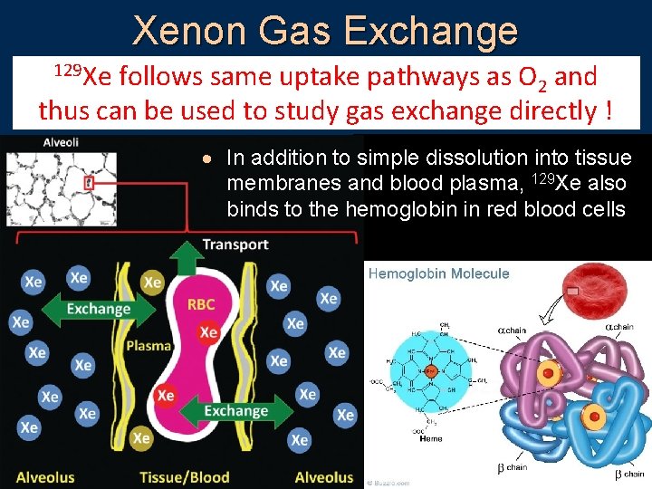 Xenon Gas Exchange 129 Xe 3 He remains confined to the lung airspaces, follows