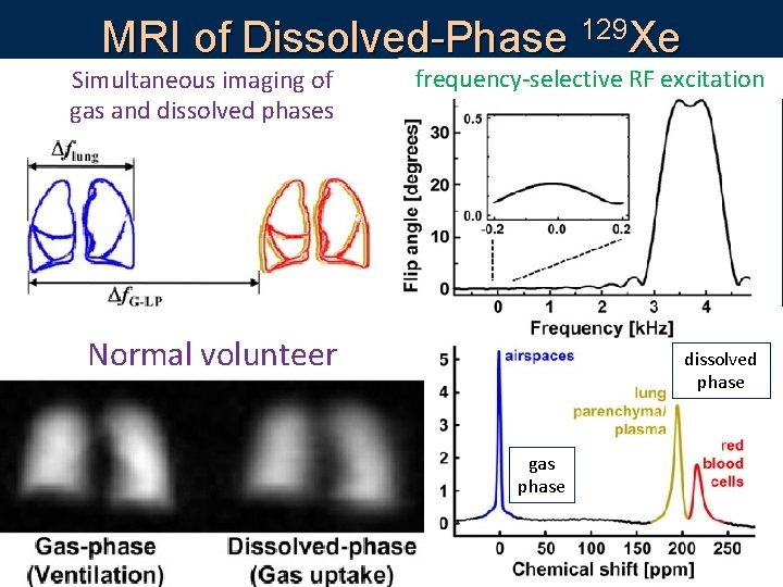 MRI of Dissolved-Phase 129 Xe Simultaneous imaging of gas and dissolved phases Clever way