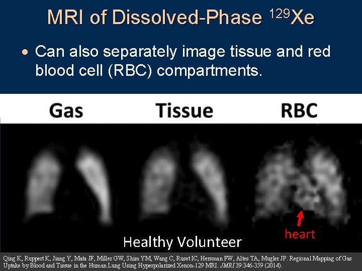 MRI of Dissolved-Phase 129 Xe · Can also separately image tissue and red blood