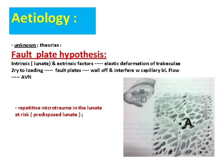 Aetiology : - unknown ; theories : Fault plate hypothesis: Intrinsic ( lunate) &