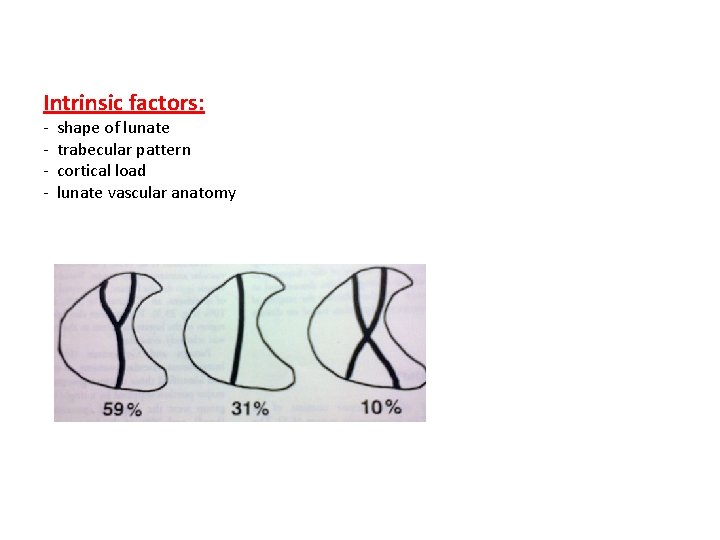 Intrinsic factors: - shape of lunate trabecular pattern cortical load lunate vascular anatomy  Intrinsic factors: - shape of lunate trabecular pattern cortical load lunate vascular anatomy