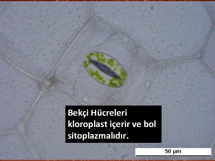 Bekçi Hücreleri kloroplast içerir ve bol sitoplazmalıdır. 