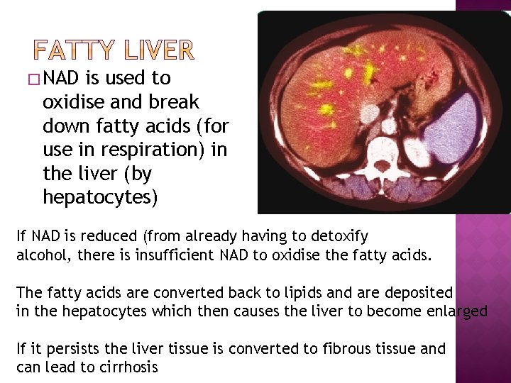 � NAD is used to oxidise and break down fatty acids (for use in