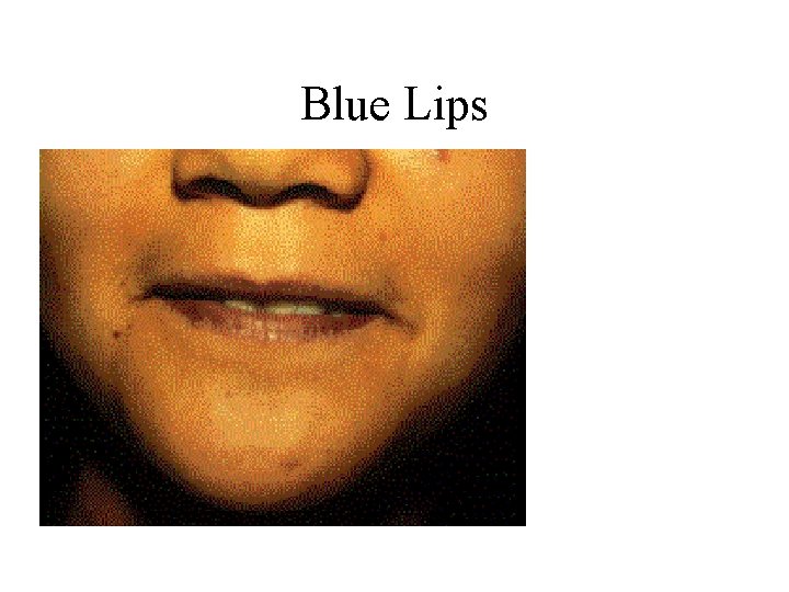 Blue Lips 