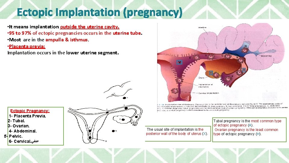 Ectopic Implantation (pregnancy) • It means implantation outside the uterine cavity. • 95 to