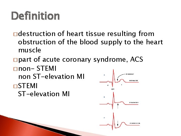 Definition � destruction of heart tissue resulting from obstruction of the blood supply to